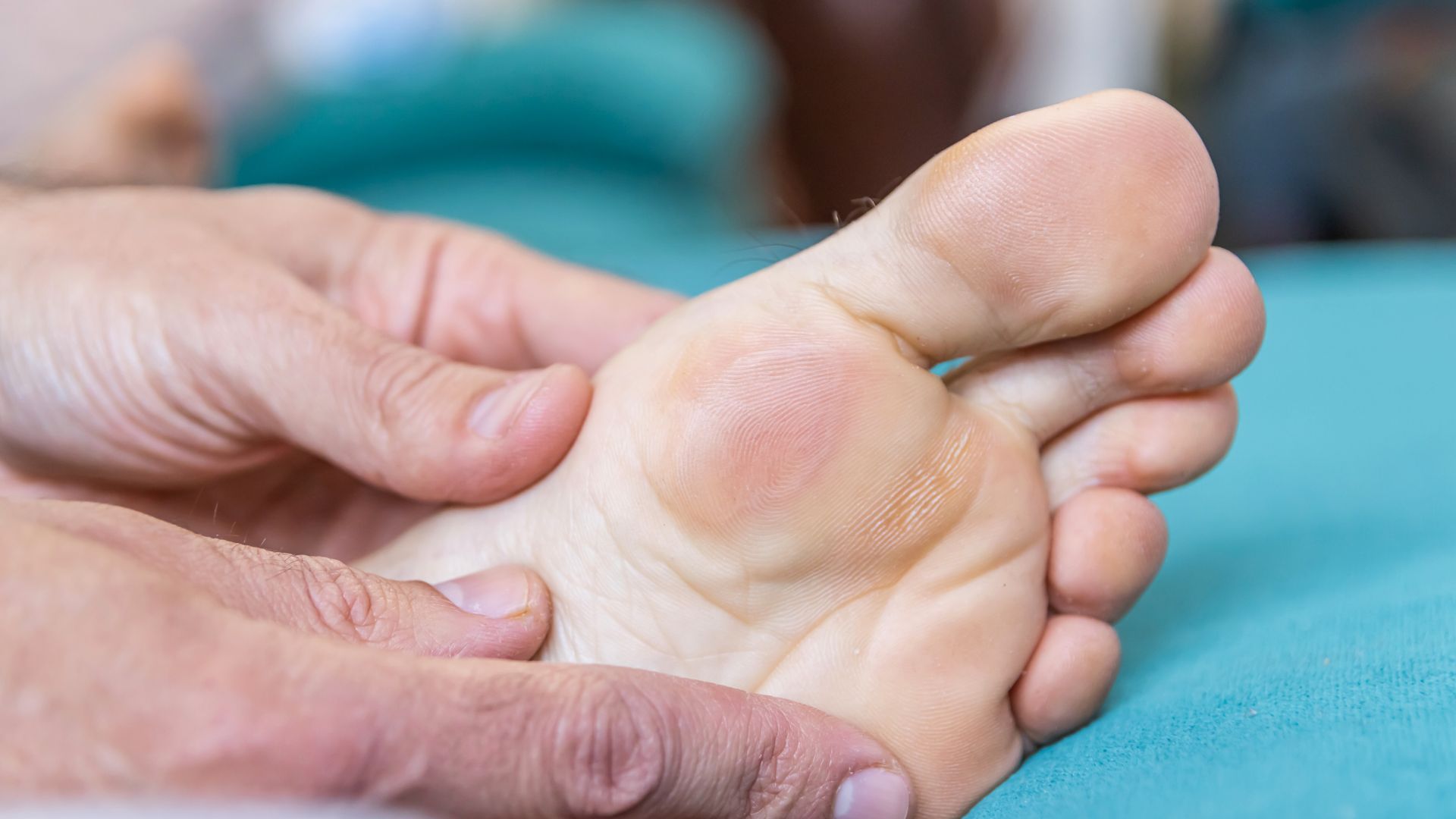 A person hold their foot showing off a blister below the big toe